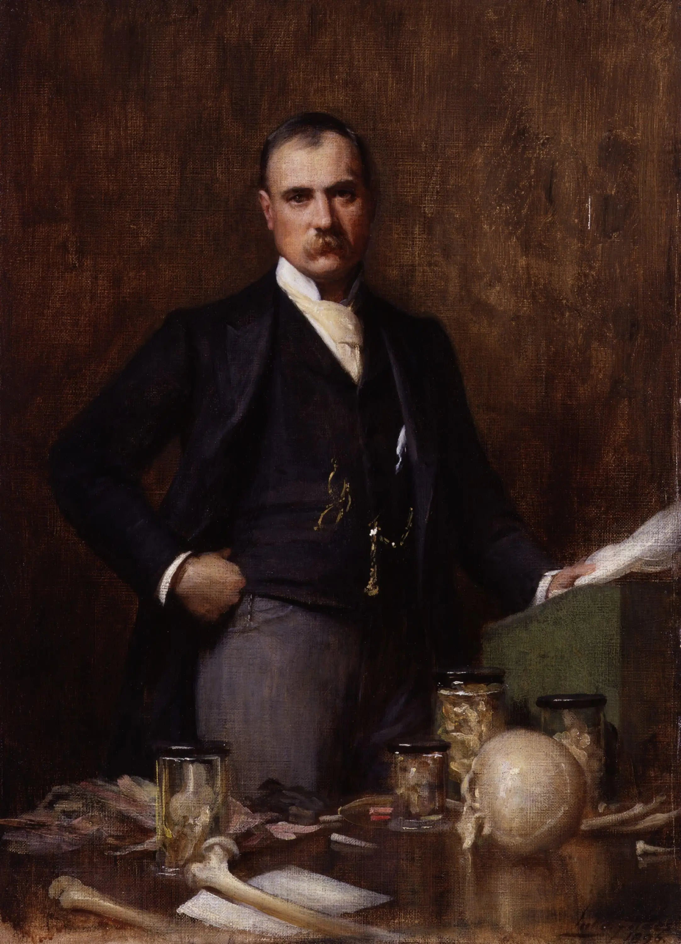 Sir Frederick Treves, 1er baronnet - Luke Fildes image 1 copie de tableau peinte à la main